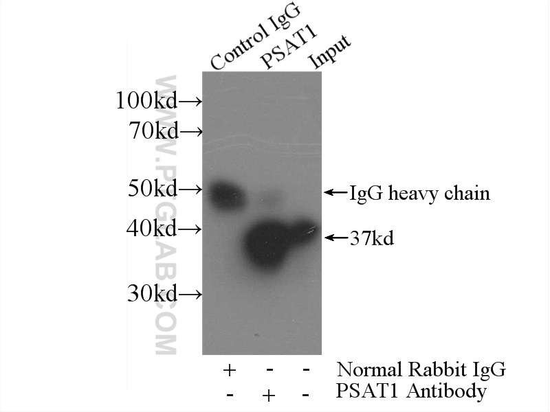 IP experiment of HeLa using 10501-1-AP