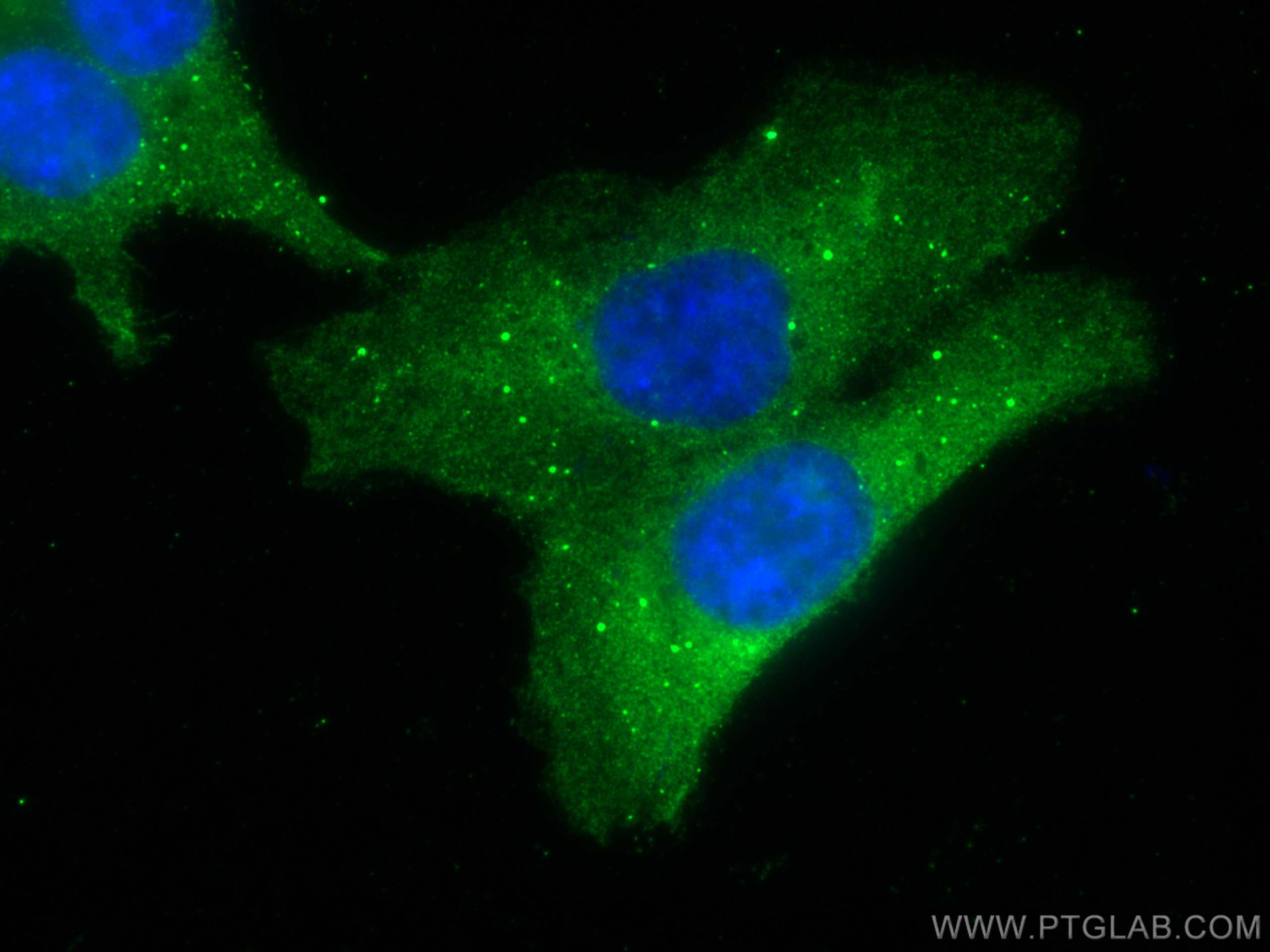 IF Staining of HCT 116 using 67619-1-Ig