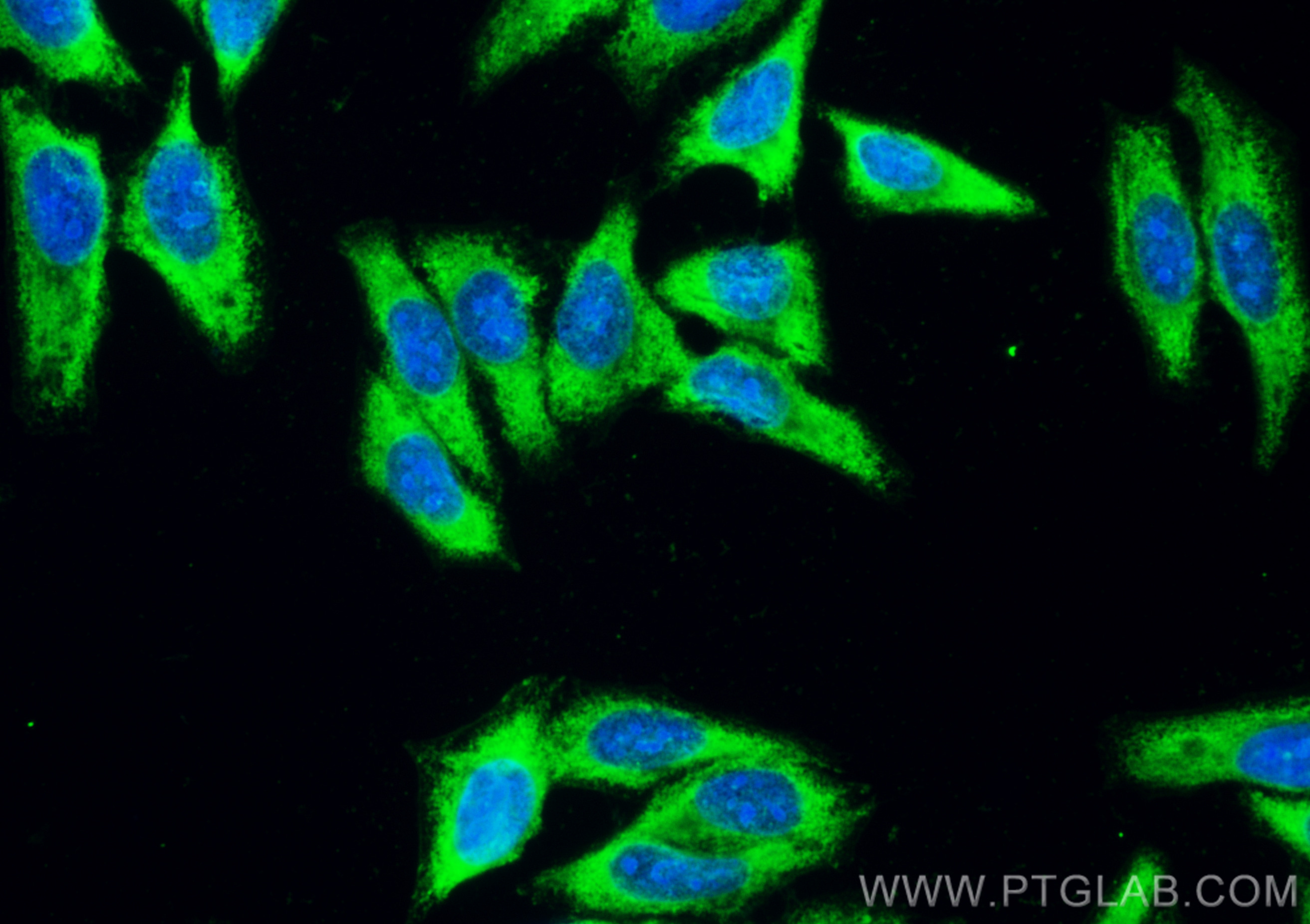 IF Staining of HepG2 using CL488-81479