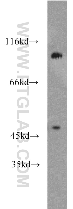 WB analysis of mouse brain using 17404-1-AP