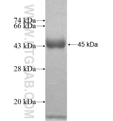 PSD2 fusion protein Ag11341 SDS-PAGE PSD2 fusion protein Ag11341 SDS-PAGE