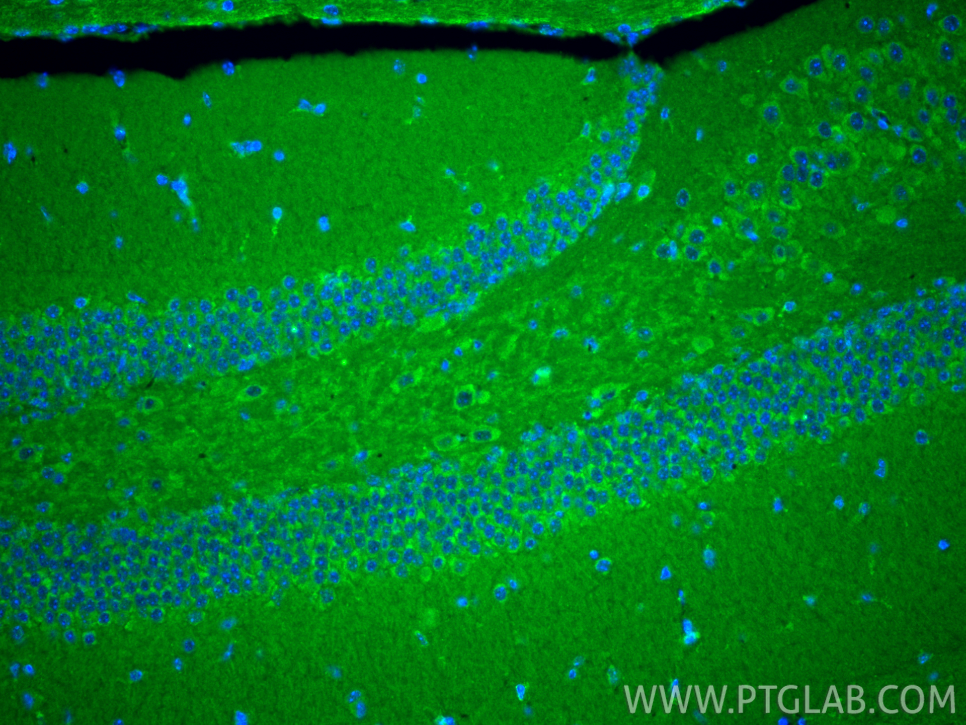 IF Staining of mouse brain using 30255-1-AP (same clone as 30255-1-PBS)