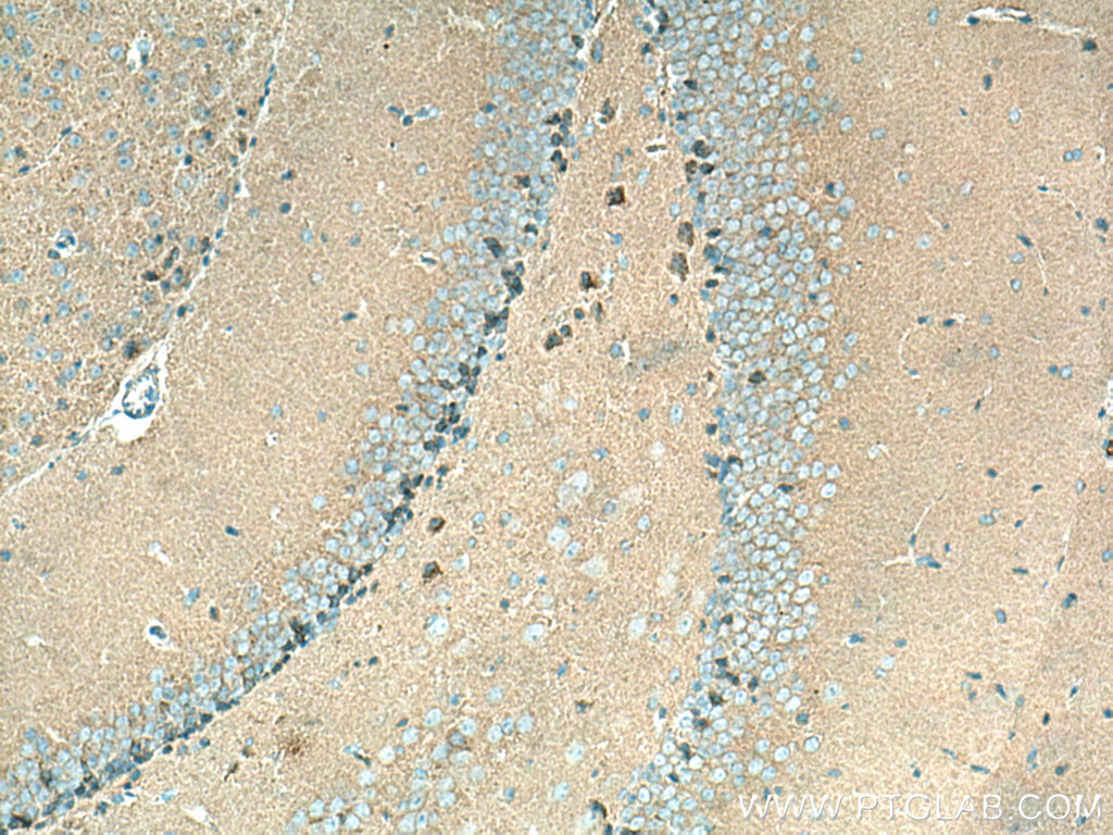 IHC staining of mouse brain using 20665-1-AP
