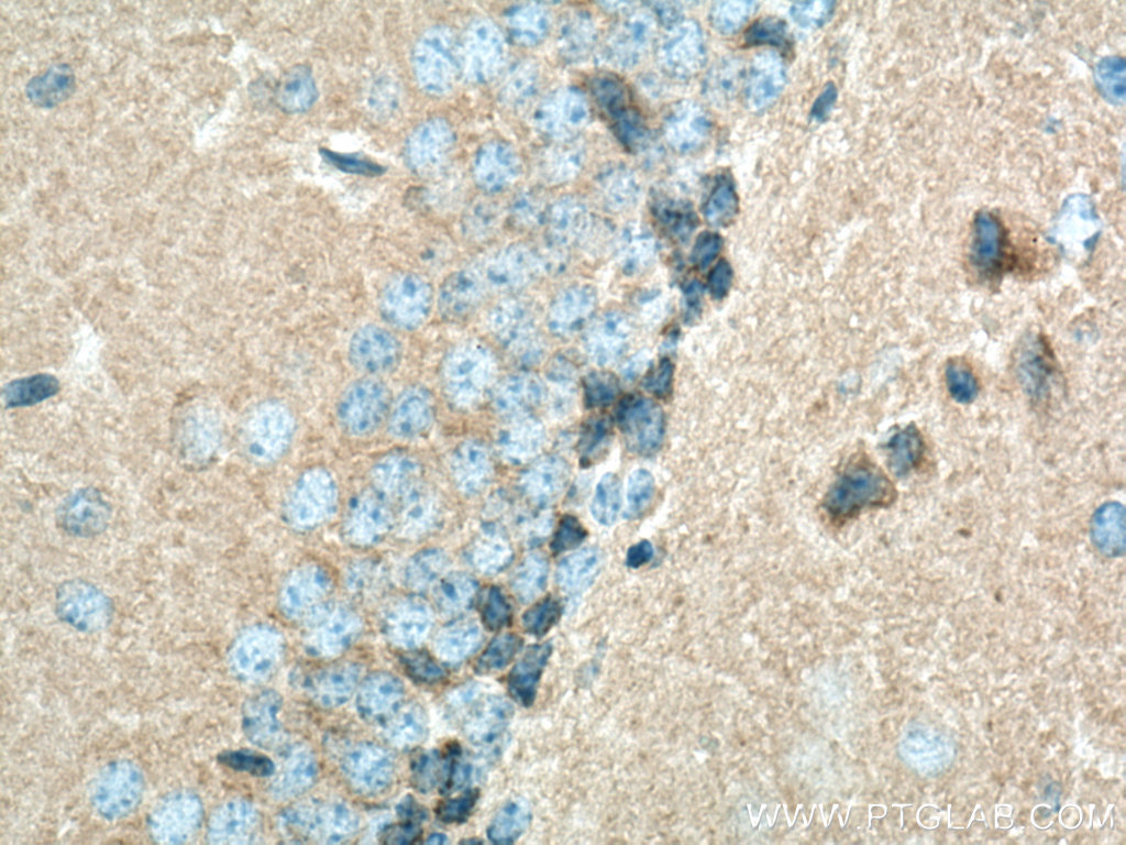 IHC staining of mouse brain using 20665-1-AP