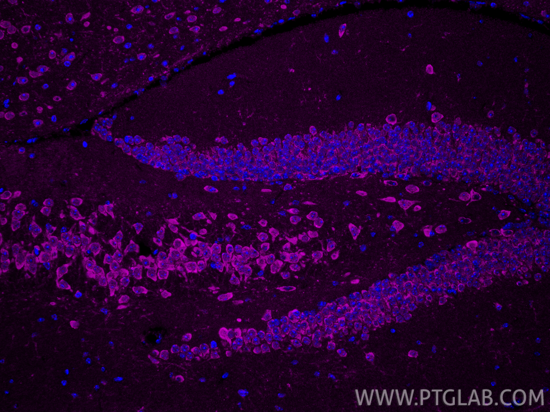 IF Staining of mouse brain using CL647-81106 IF Staining of mouse brain using CL647-81106
