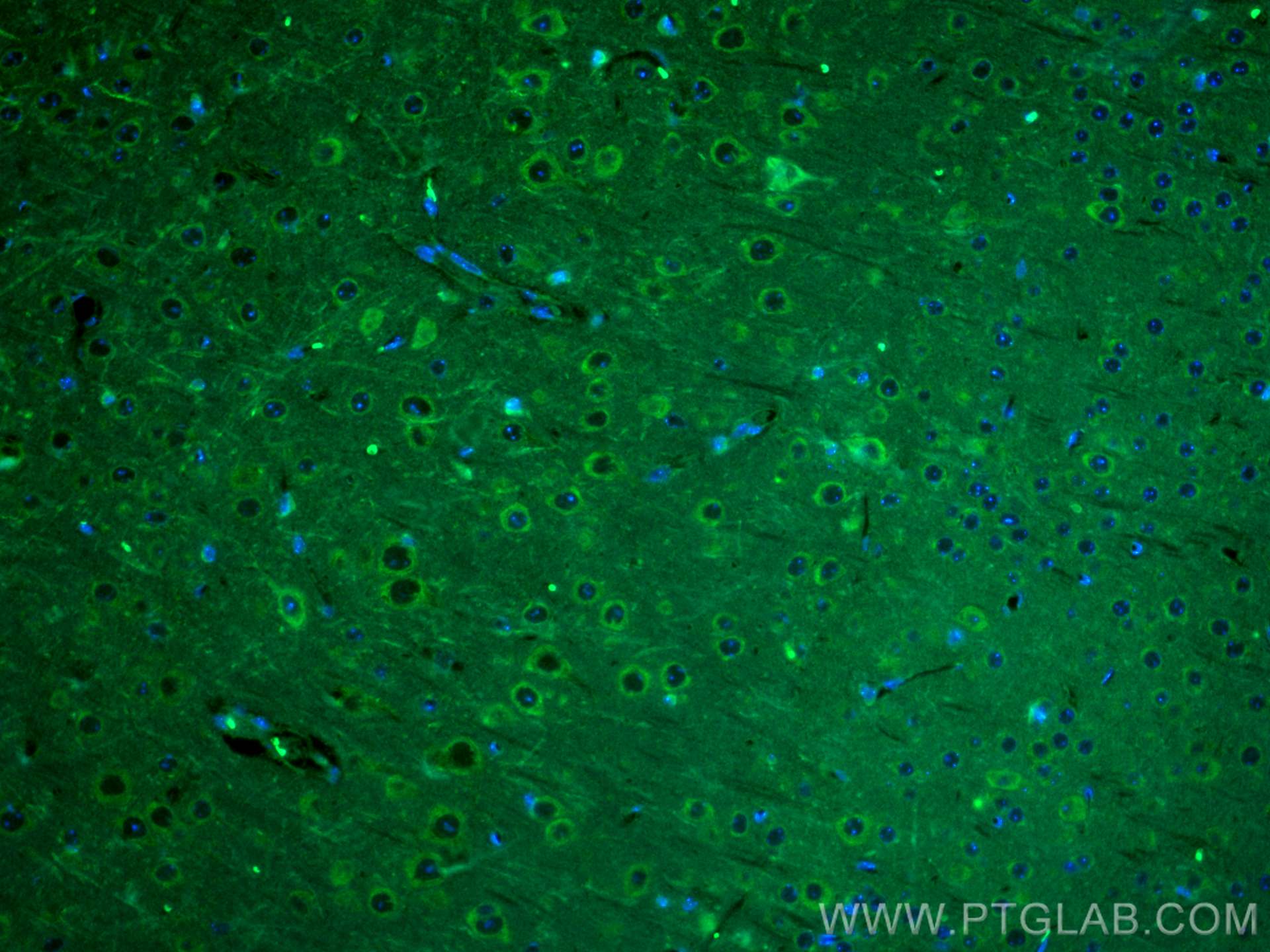 IF Staining of mouse brain using CL488-20665