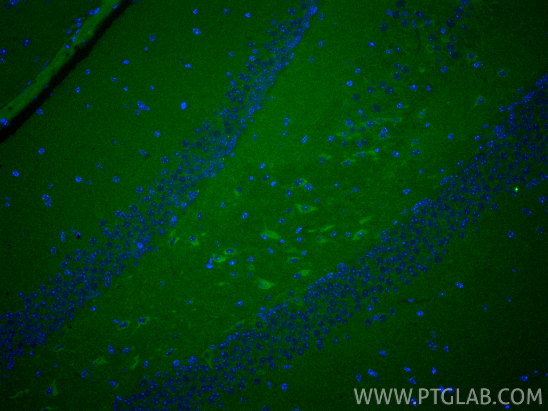 IF Staining of mouse brain using CL488-20665 IF Staining of mouse brain using CL488-20665