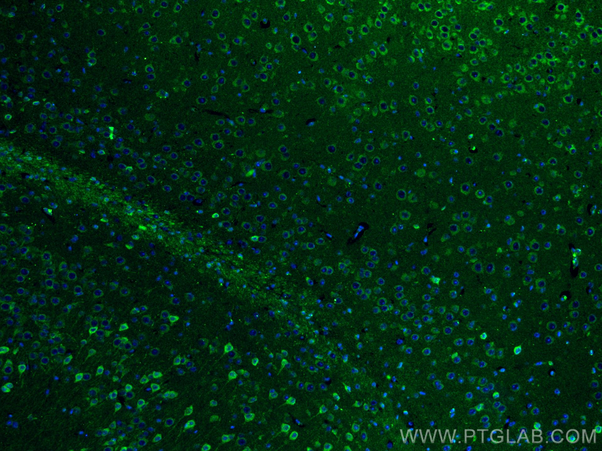 IF Staining of mouse brain using 20434-1-AP