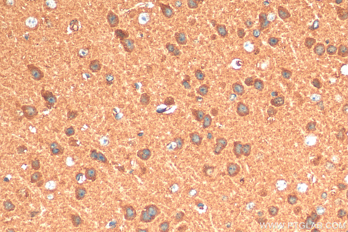 IHC staining of mouse brain using 16163-1-AP