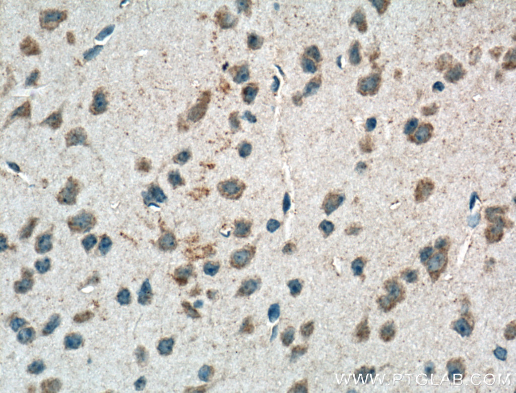 IHC staining of mouse brain using 16144-1-AP