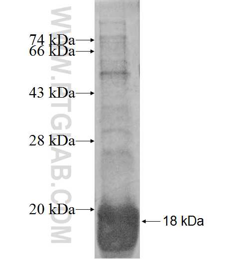 PSENEN fusion protein Ag9067 SDS-PAGE PSENEN fusion protein Ag9067 SDS-PAGE