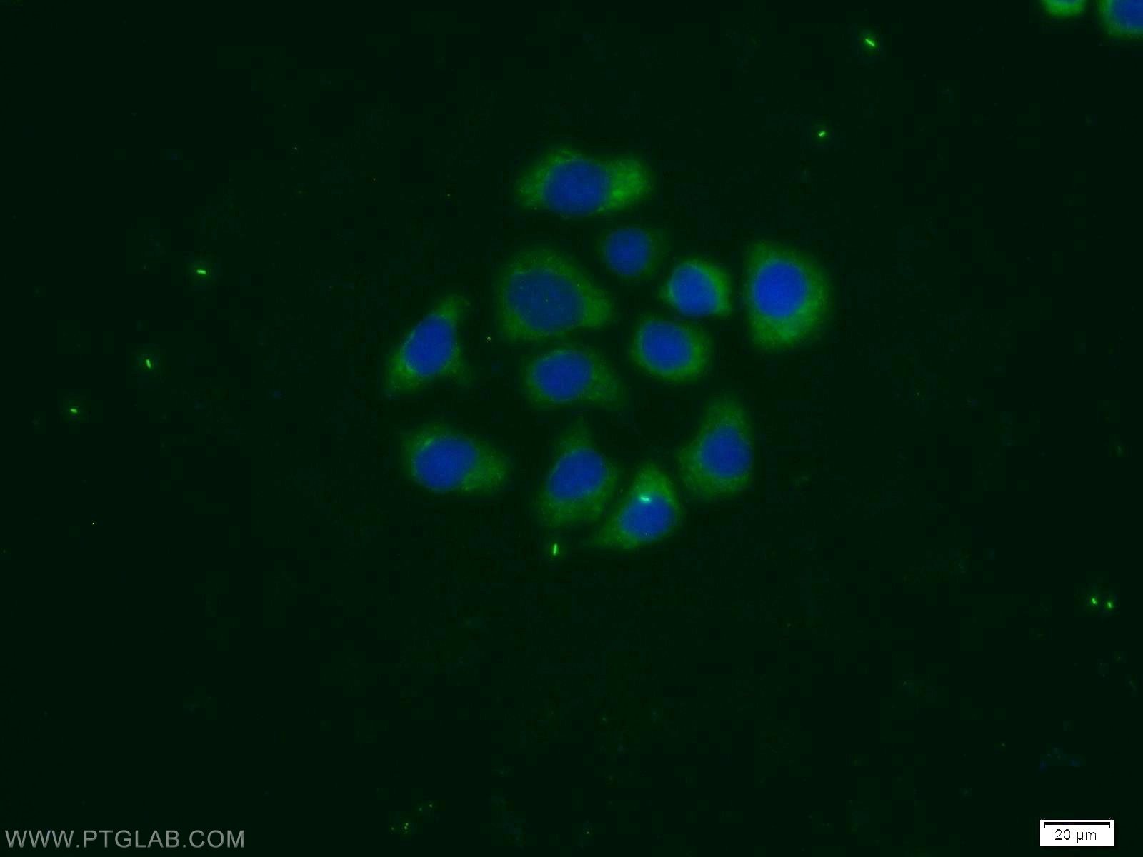 IF Staining of MCF-7 using 11809-1-AP