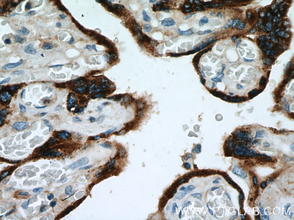 IHC staining of human placenta using 11809-1-AP