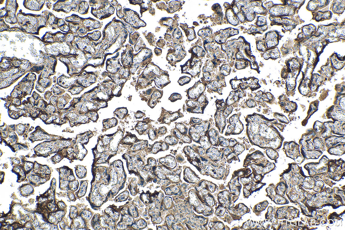 IHC staining of human placenta using 67269-1-Ig