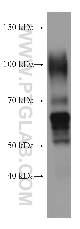 WB analysis of human placenta using 67269-1-Ig