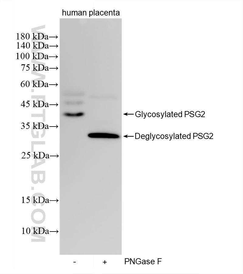 WB analysis using 87951-1-RR (same clone as 87951-1-PBS) WB analysis using 87951-1-RR (same clone as 87951-1-PBS)