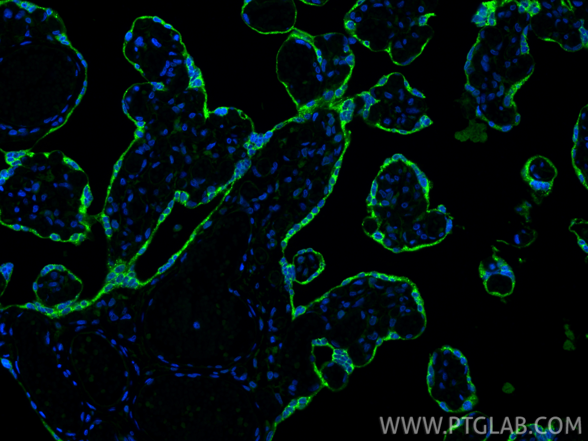 IF Staining of human placenta using 10902-2-AP