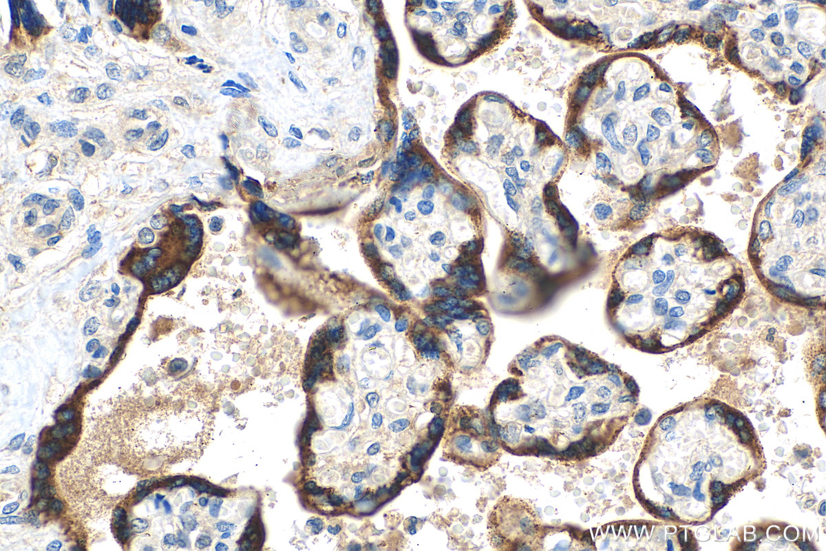 IHC staining of human placenta using 10902-2-AP