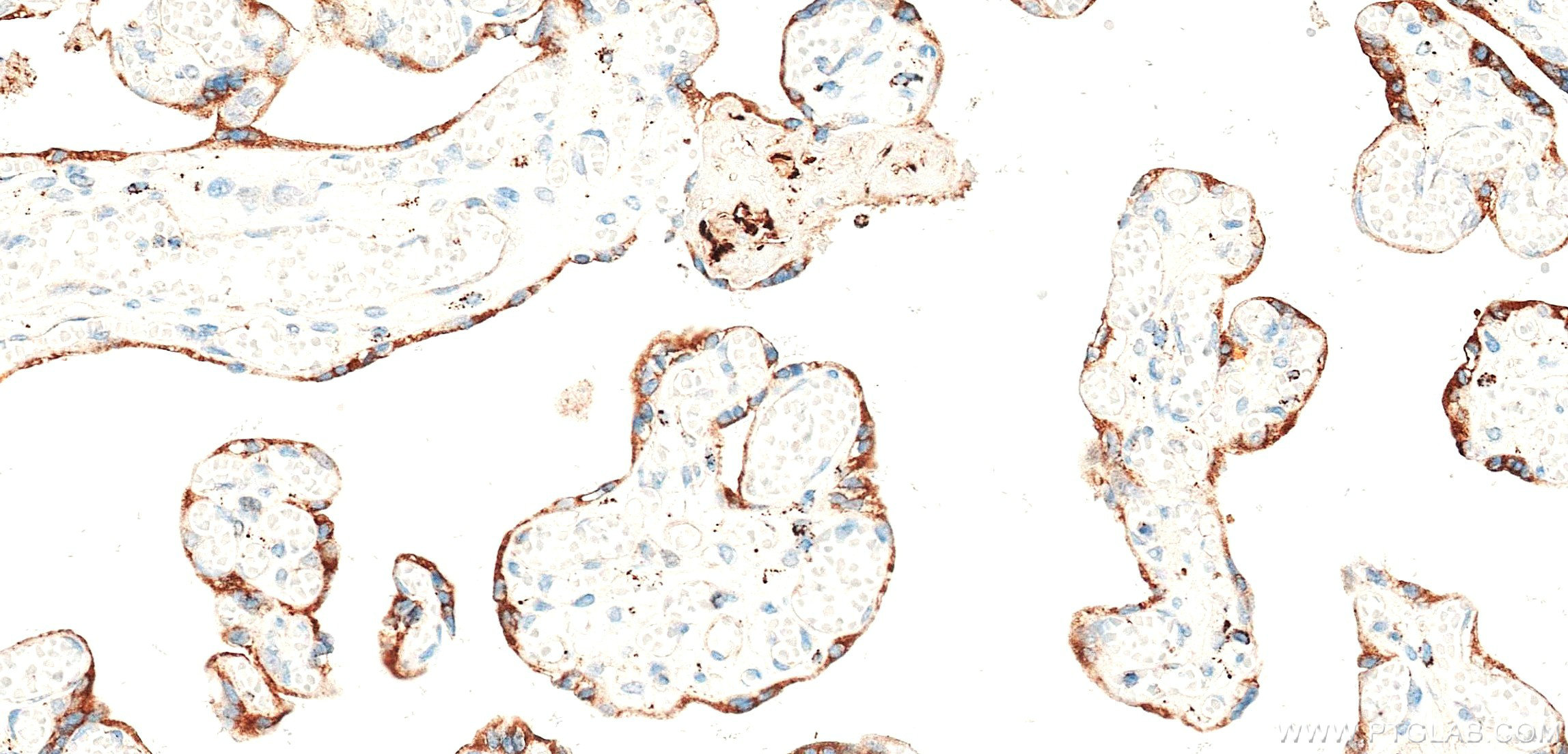 IHC staining of human placenta using 87878-3-RR (same clone as 87878-3-PBS) IHC staining of human placenta using 87878-3-RR (same clone as 87878-3-PBS)