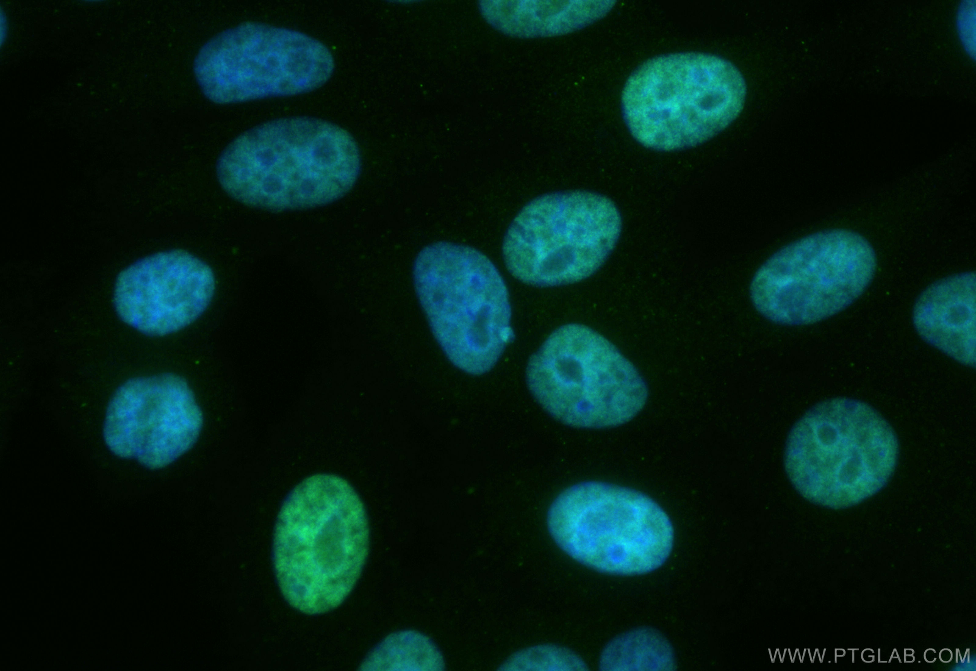 IF Staining of HepG2 using CL488-85395