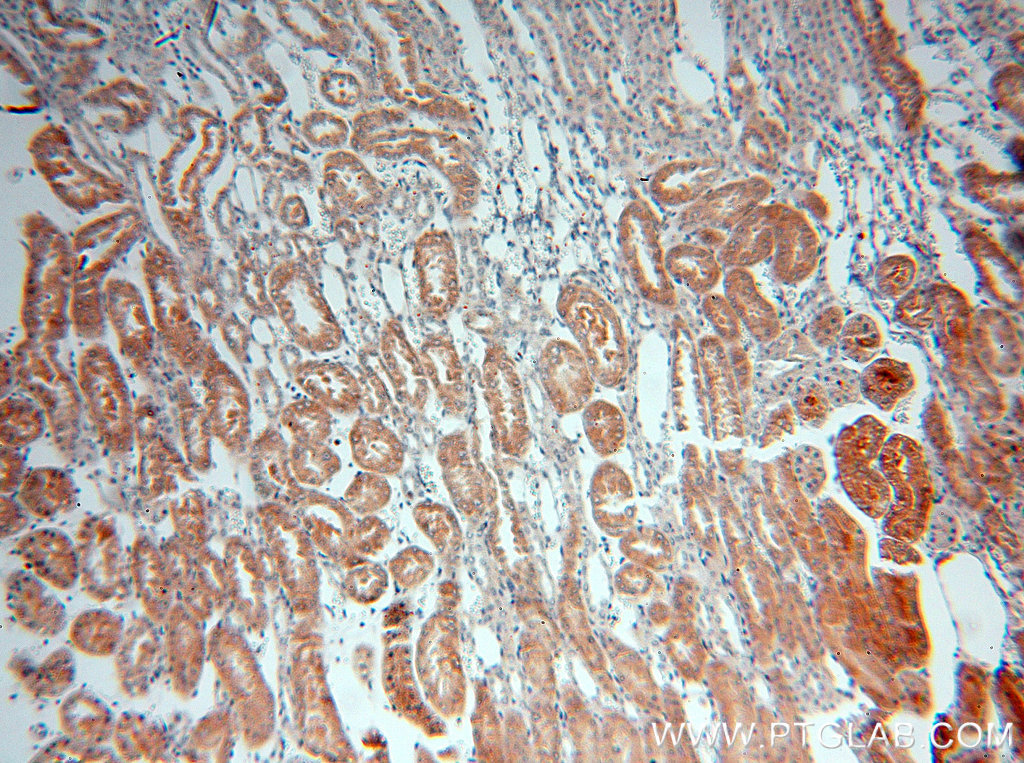 IHC staining of human kidney using 18813-1-AP