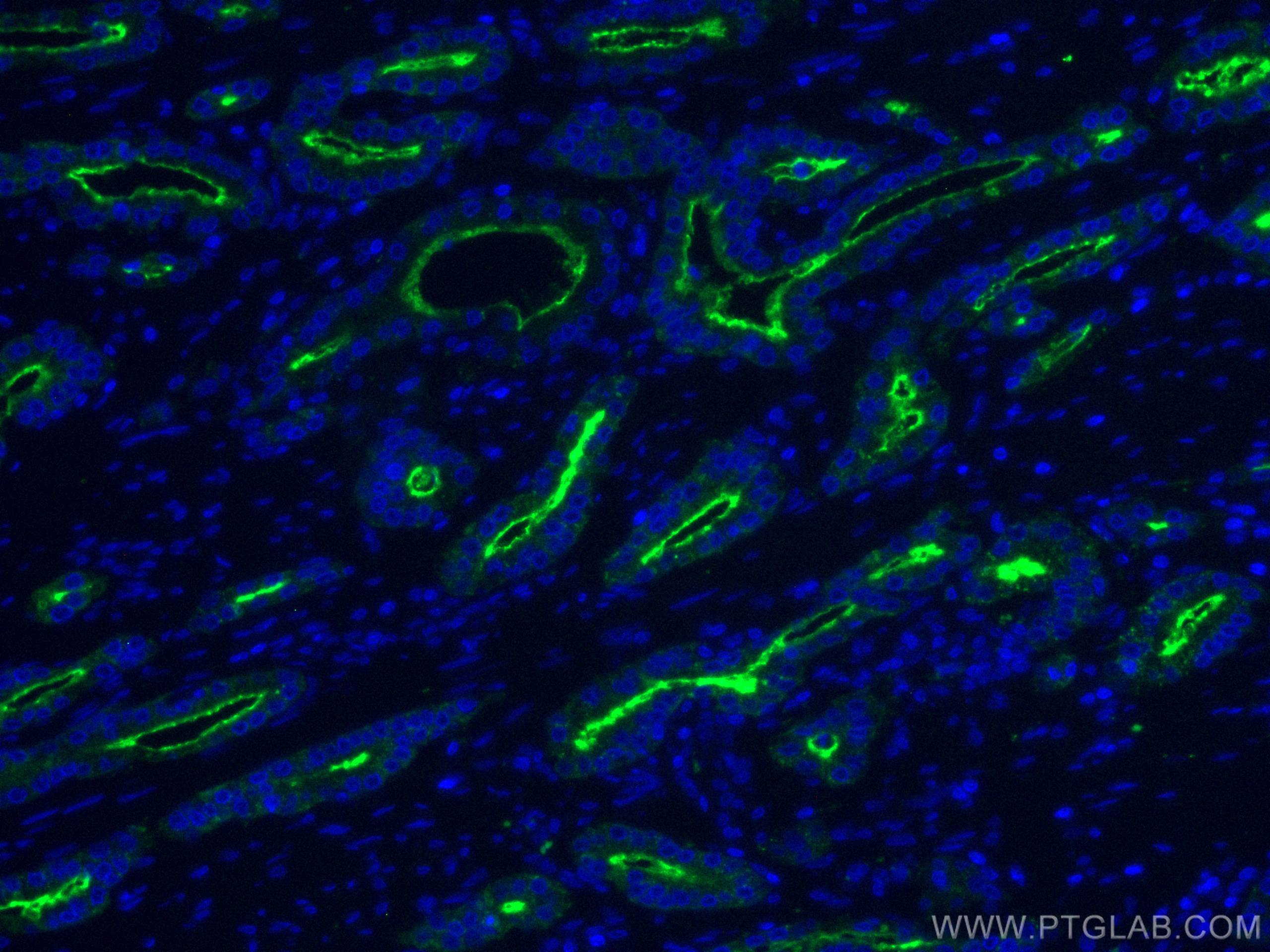 IF Staining of human prostate cancer using CL488-66678