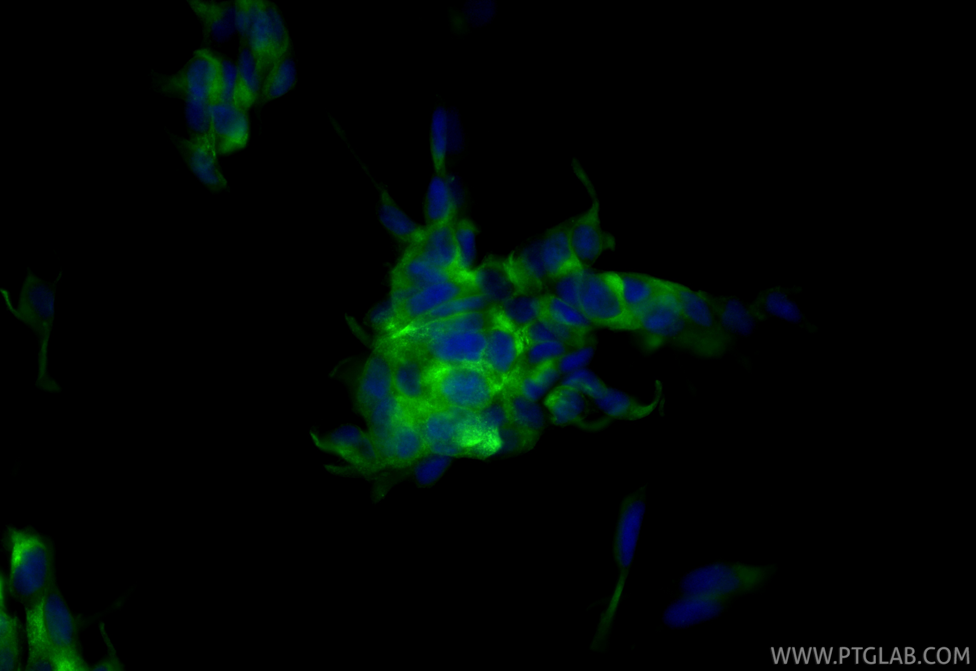 Immunofluorescent analysis of (4% PFA) fixed LNCaP cells using CoraLite® Plus 488 PSMA/GCPII antibody (CL488-84615-2, Clone: 242026F4 ) at dilution of 1:200. IF Staining of LNCaP using CL488-84615-2