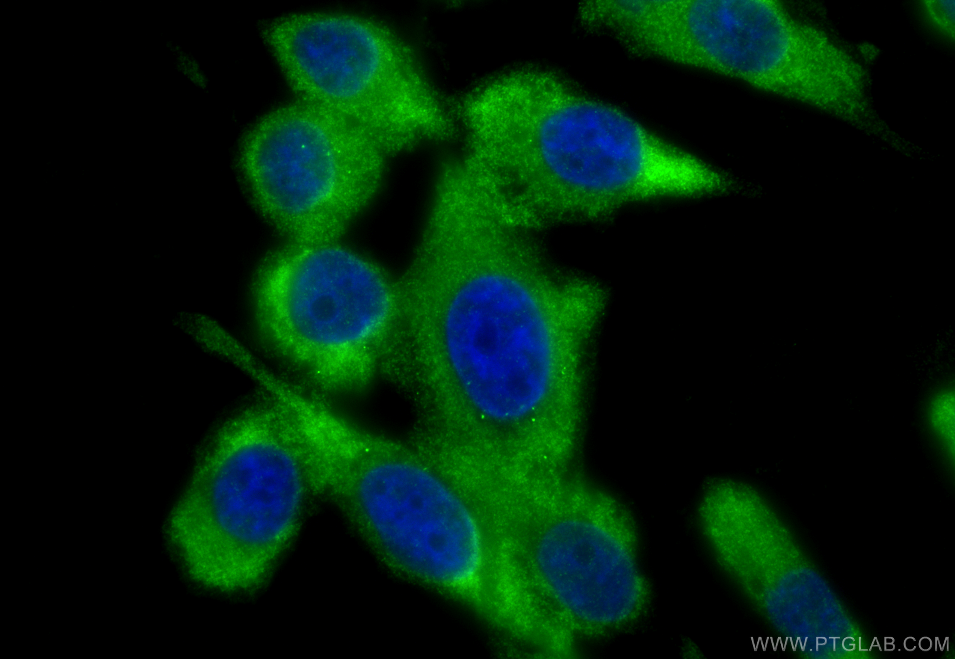 IF Staining of PC-3 using 11175-1-AP