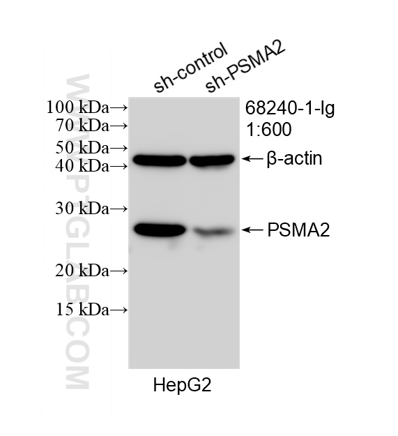 WB result of PSMA2 antibody (68240-1-Ig; 1:600; incubated at room temperature for 1.5 hours) with sh-Control and sh-PSMA2 transfected HepG2 cells. WB analysis of HepG2 using 68240-1-Ig