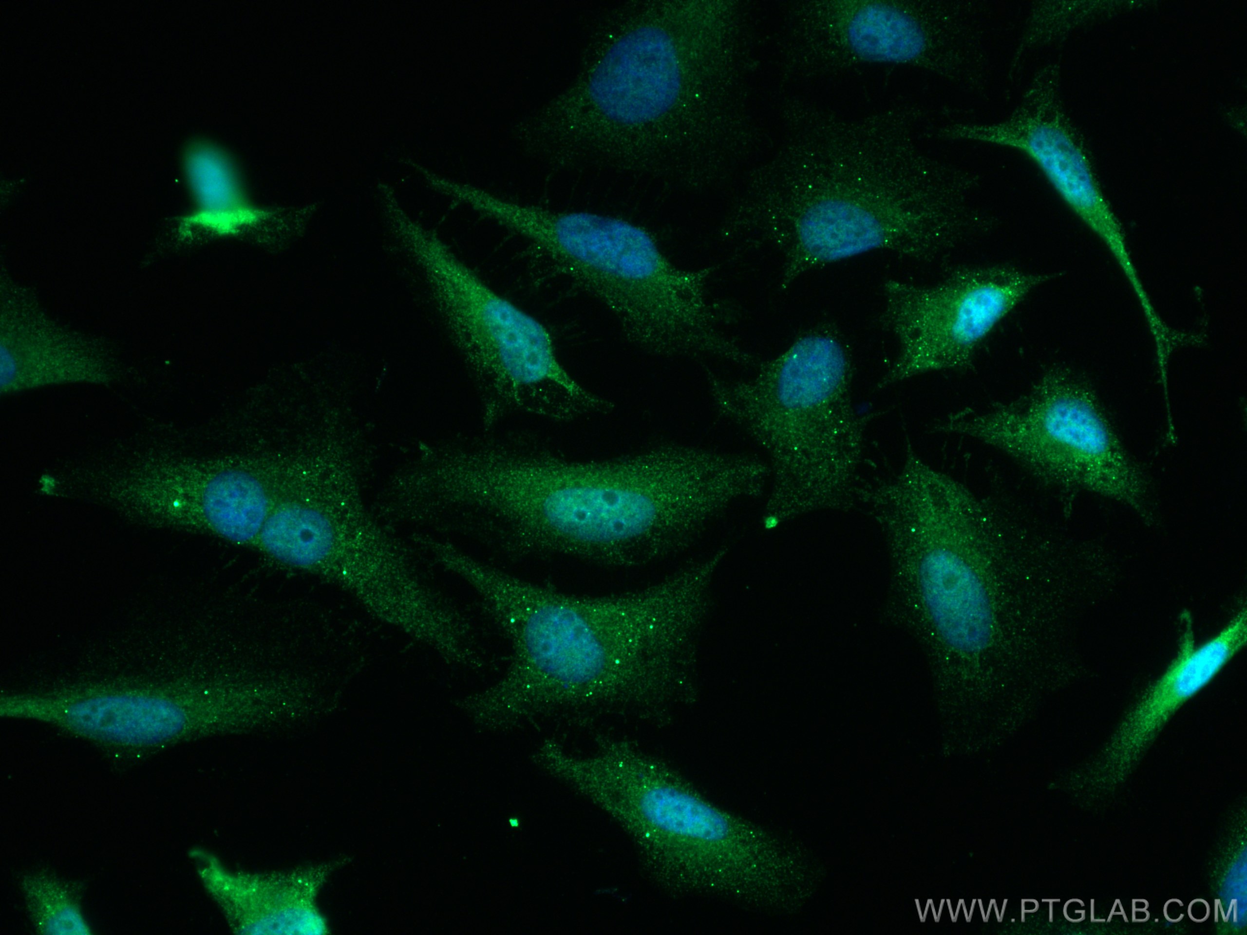 IF Staining of HeLa using 11887-1-AP