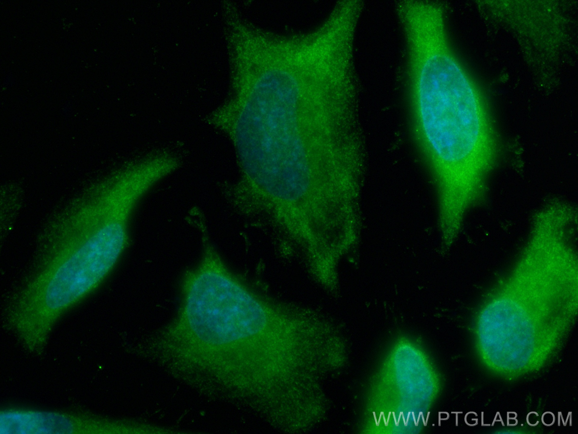 IF Staining of HeLa using 68203-1-Ig