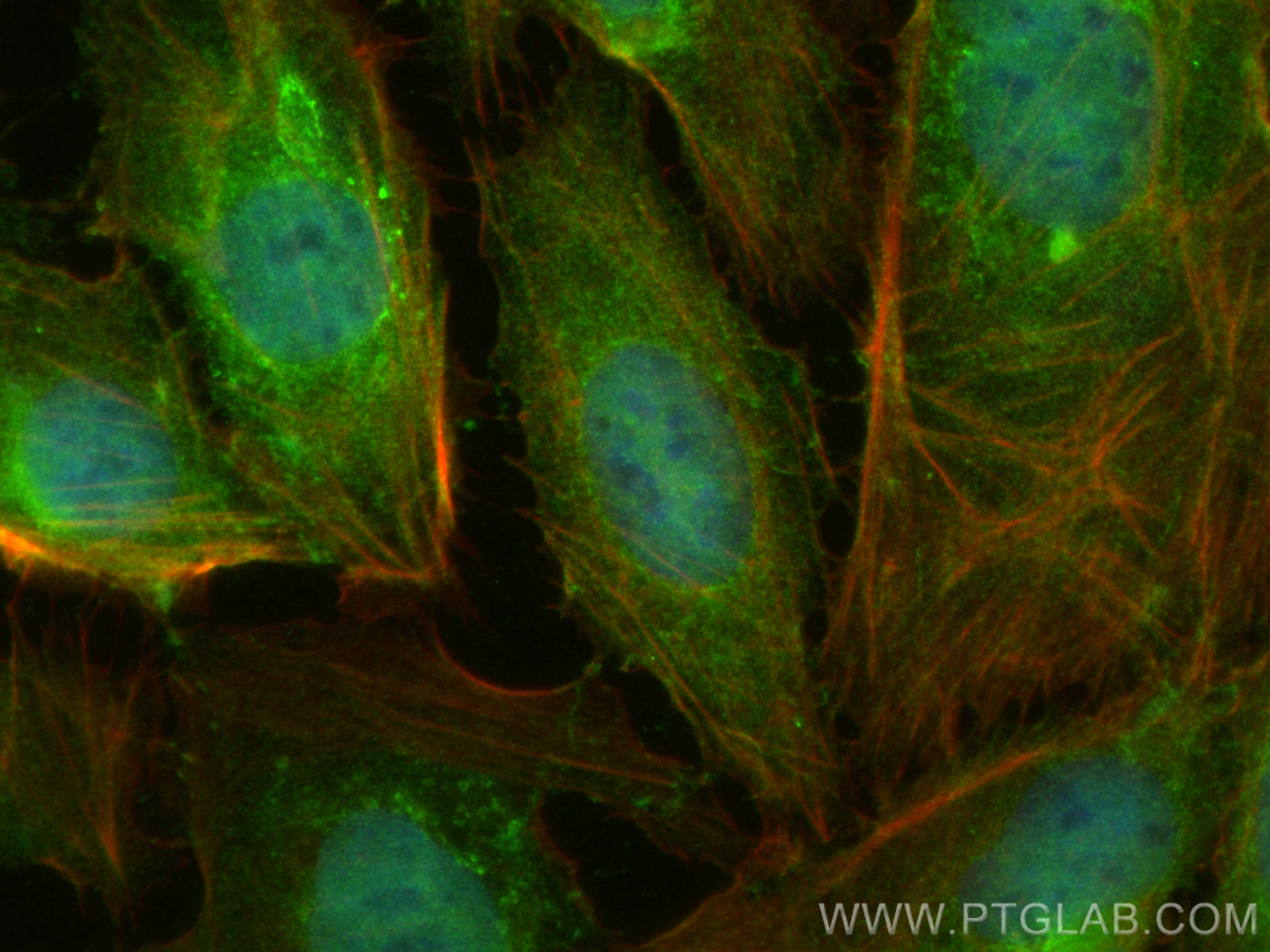 IF Staining of U2OS using 31384-1-AP