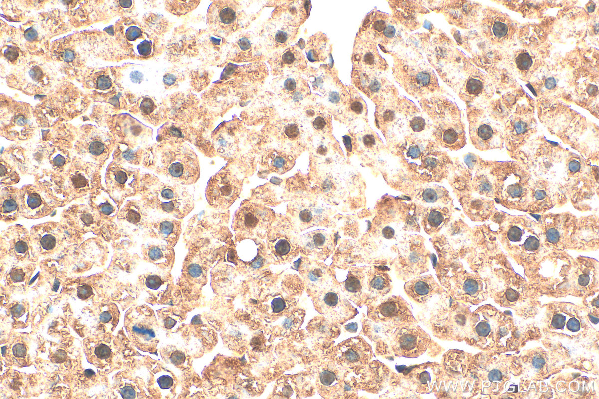 IHC staining of rat liver using 31384-1-AP