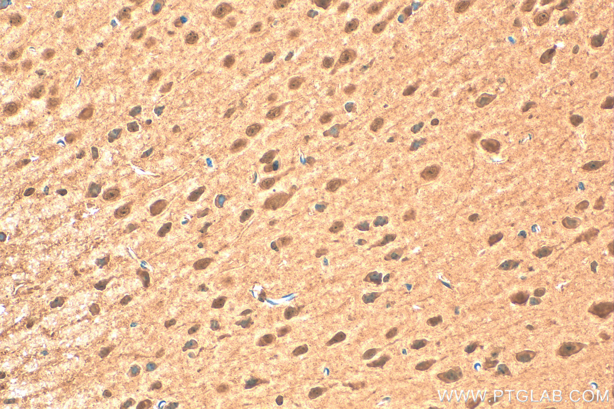 IHC staining of mouse brain using 31384-1-AP