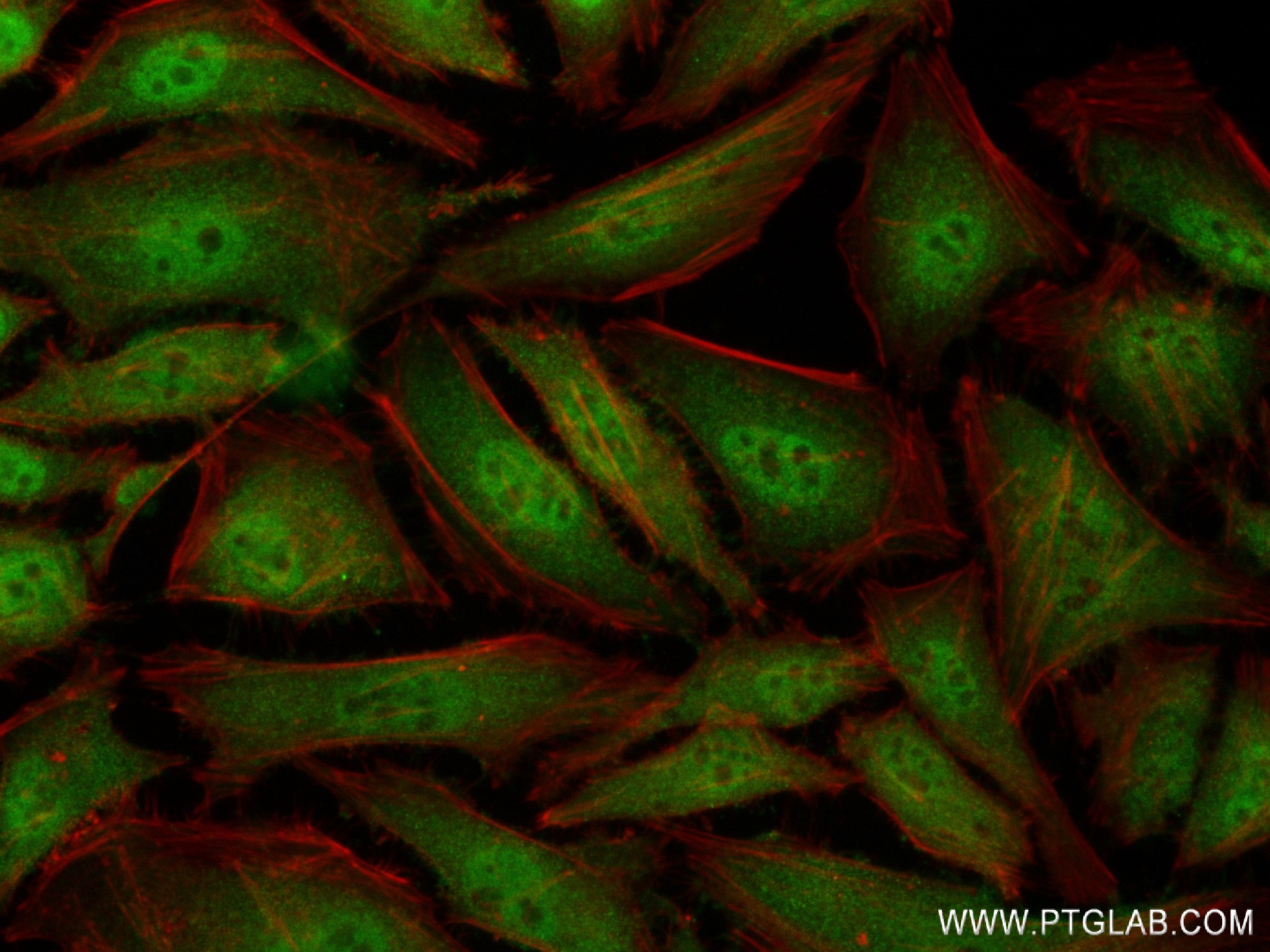 IF Staining of HeLa using 84424-4-RR