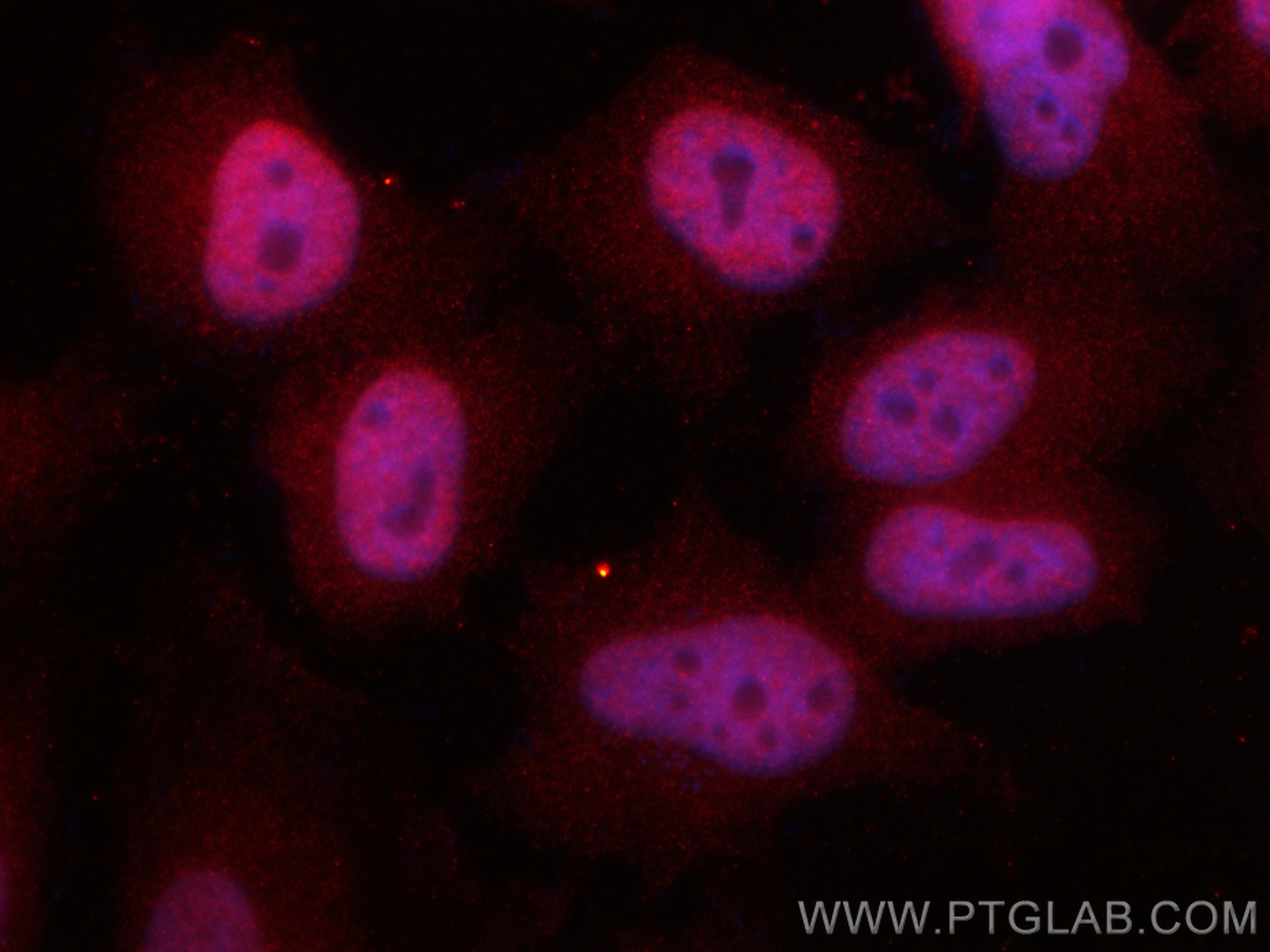 IF Staining of HeLa using 84424-4-RR