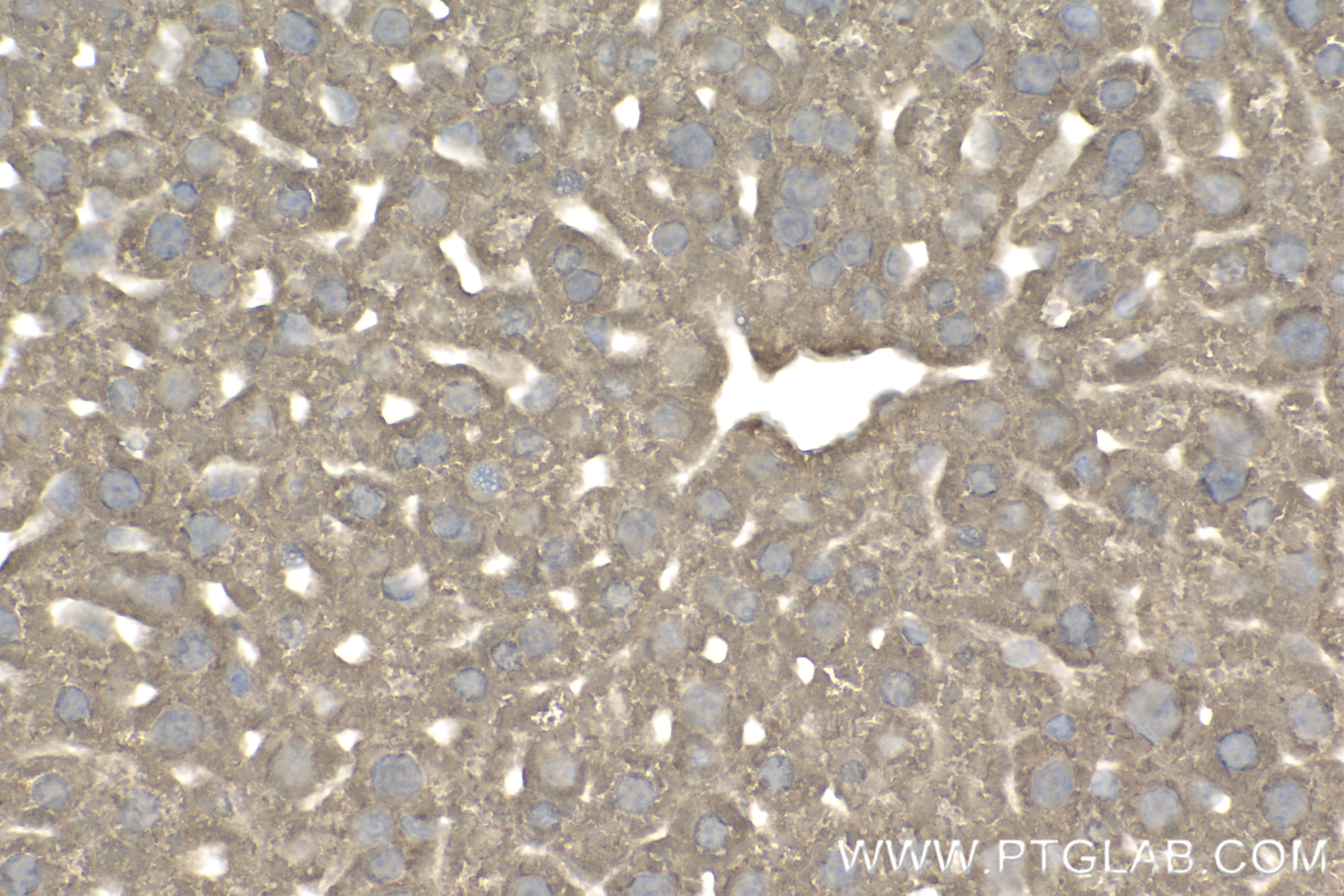 IHC staining of mouse liver using 84424-4-RR