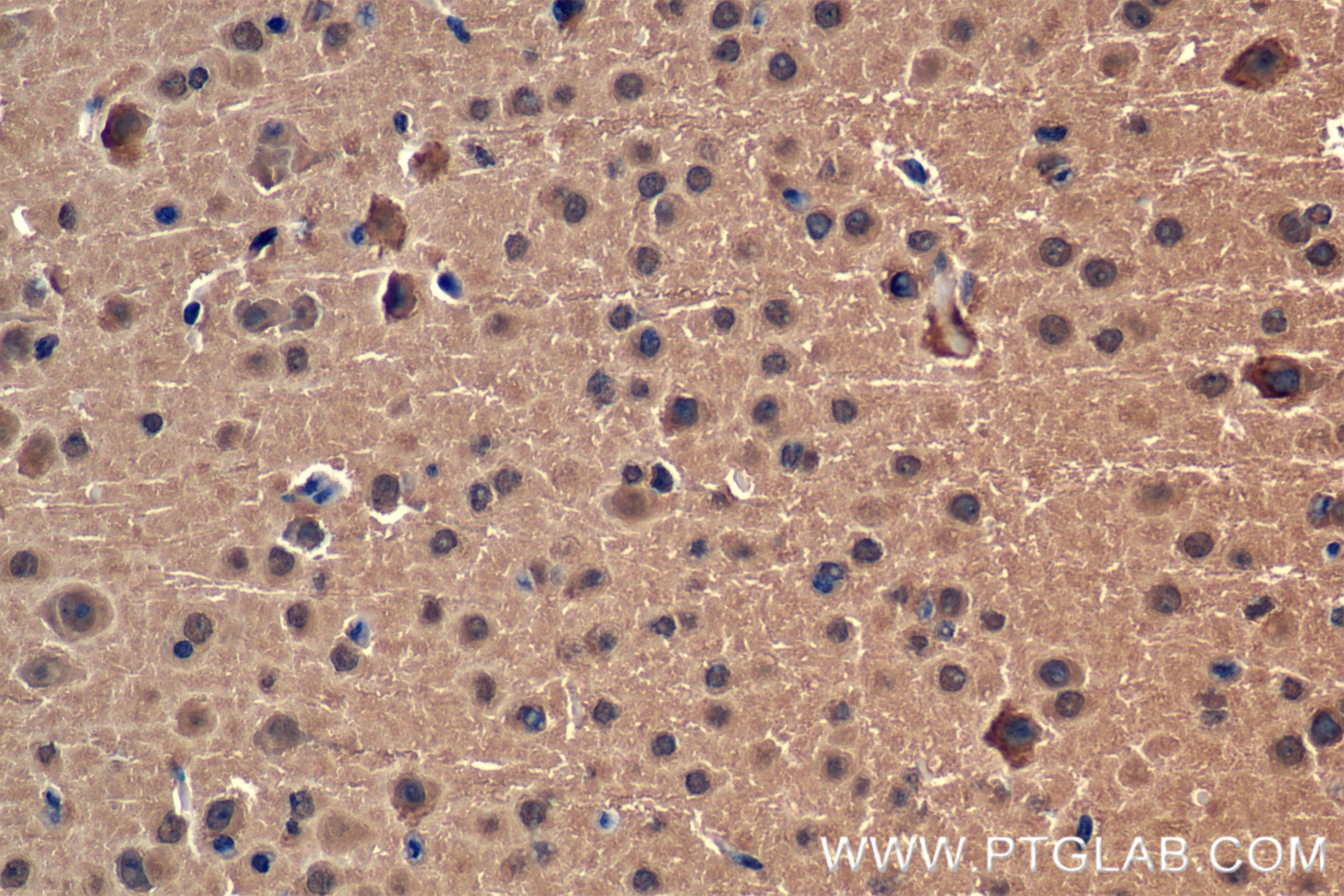 IHC staining of mouse brain using 84424-4-RR