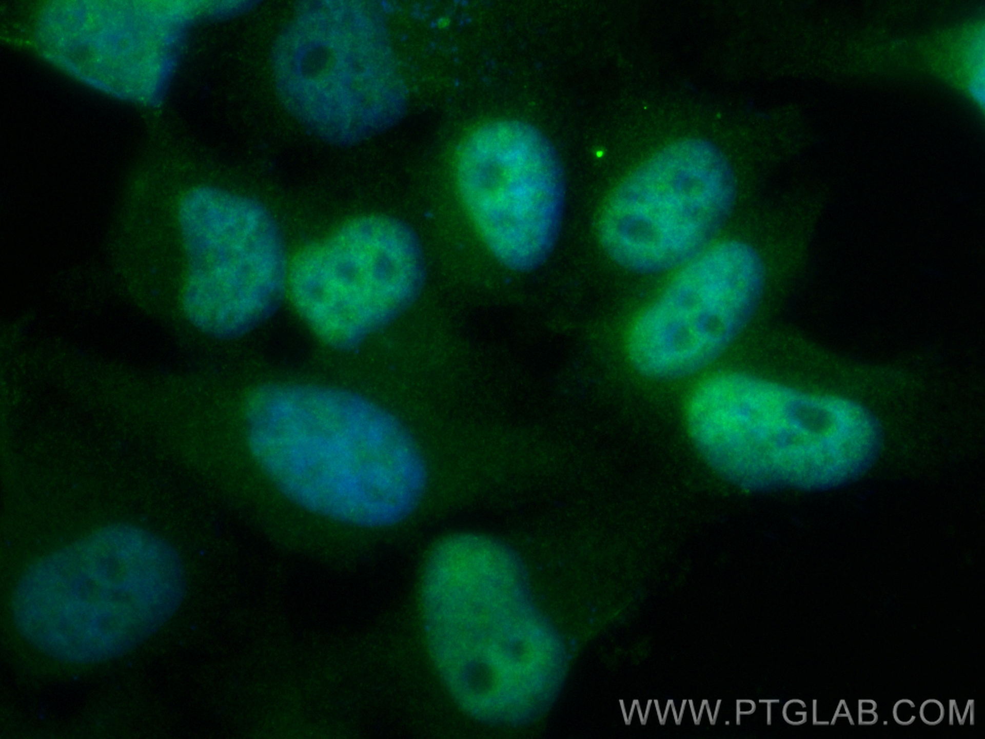IF Staining of HeLa using CL488-84424-4