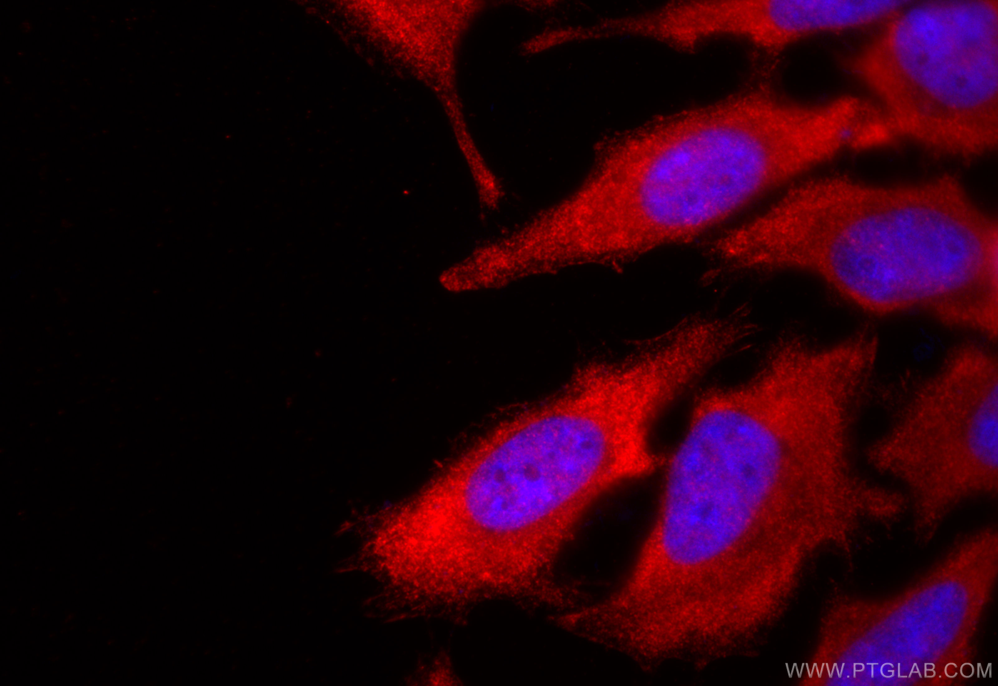 IF Staining of HeLa using 11573-1-AP