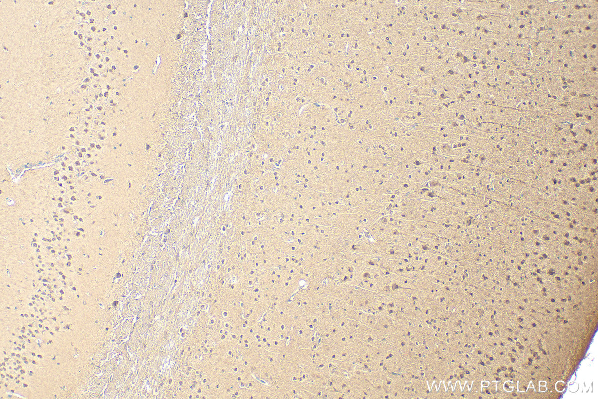 IHC staining of mouse brain using 11573-1-AP
