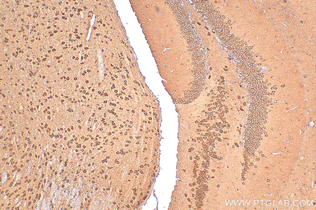 Immunohistochemical analysis of paraffin-embedded mouse brain tissue slide using 15219-1-AP (PSMA7 antibody) at dilution of 1:1000 (under 10x lens). Heat mediated antigen retrieval with Tris-EDTA buffer (pH 9.0). IHC staining of mouse brain using 15219-1-AP
