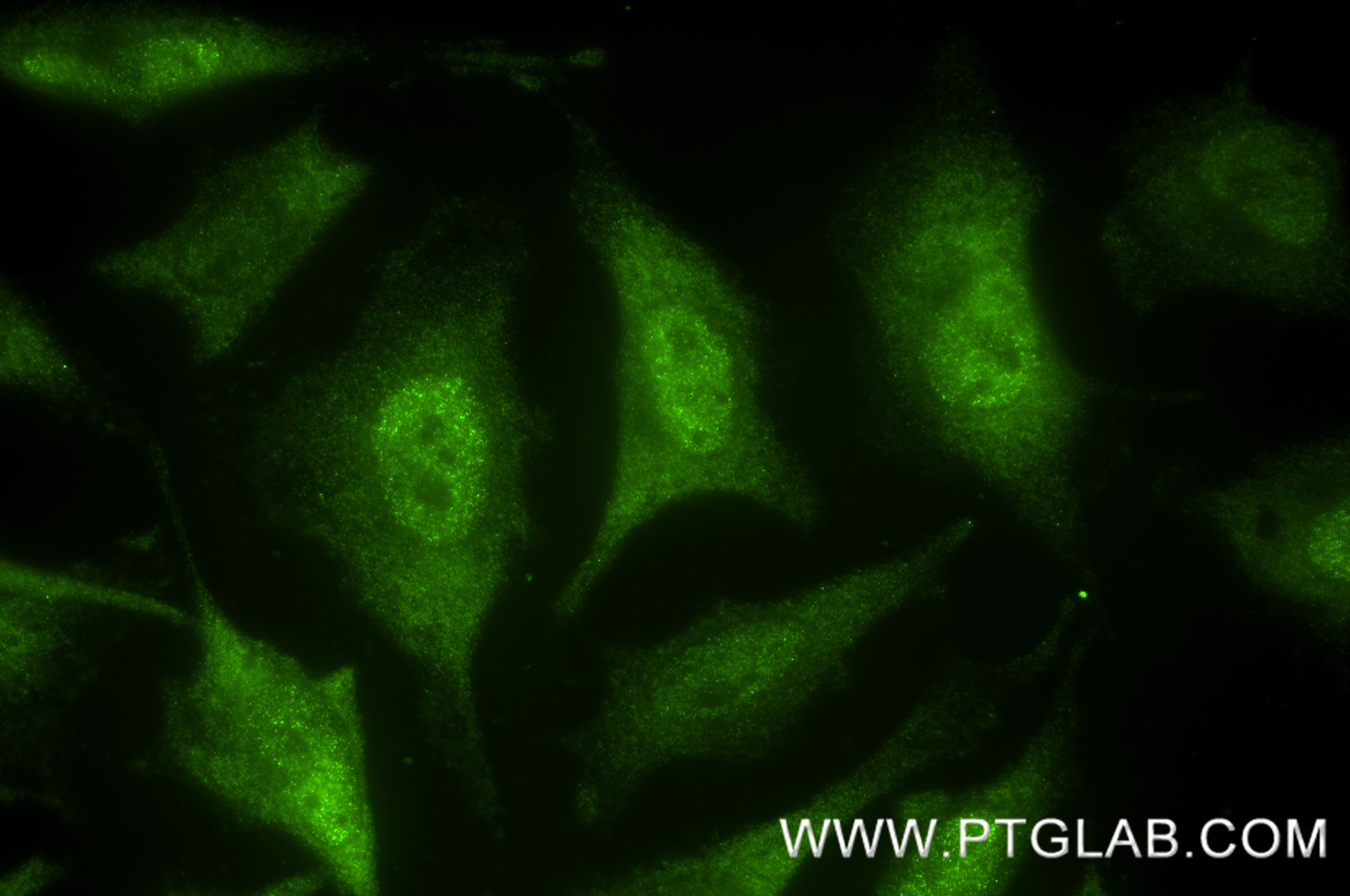 IF Staining of HeLa using 87190-3-RR IF Staining of HeLa using 87190-3-RR