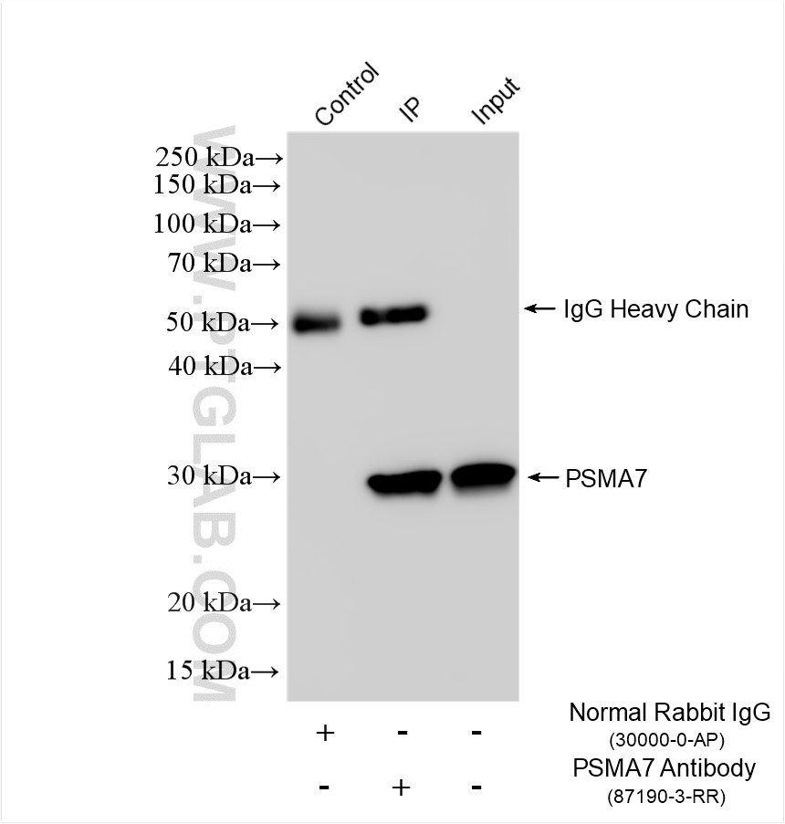 IP experiment of HeLa using 87190-3-RR