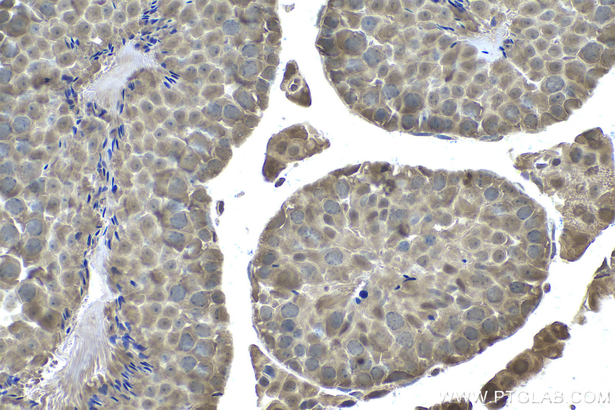 IHC staining of mouse testis using 68123-1-Ig