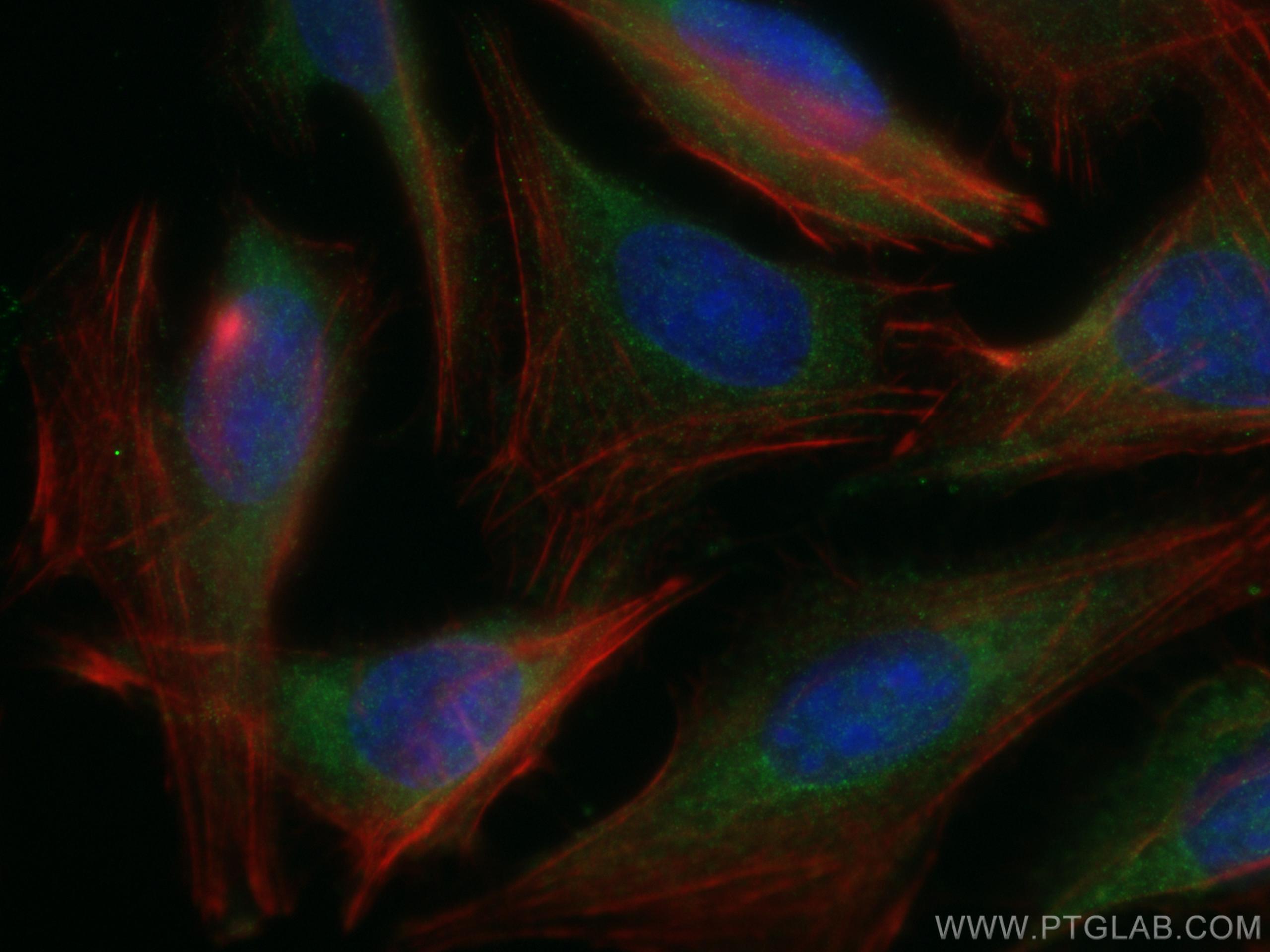 IF Staining of U2OS using 11749-1-AP