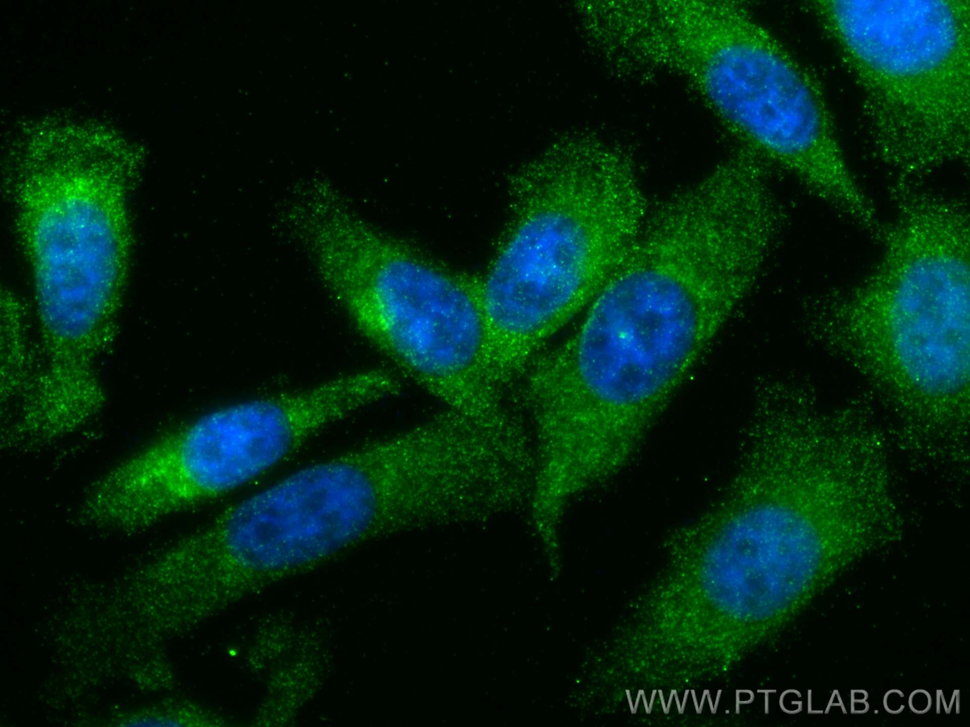 IF Staining of PC-3 using 68180-1-Ig (same clone as 68180-1-PBS)