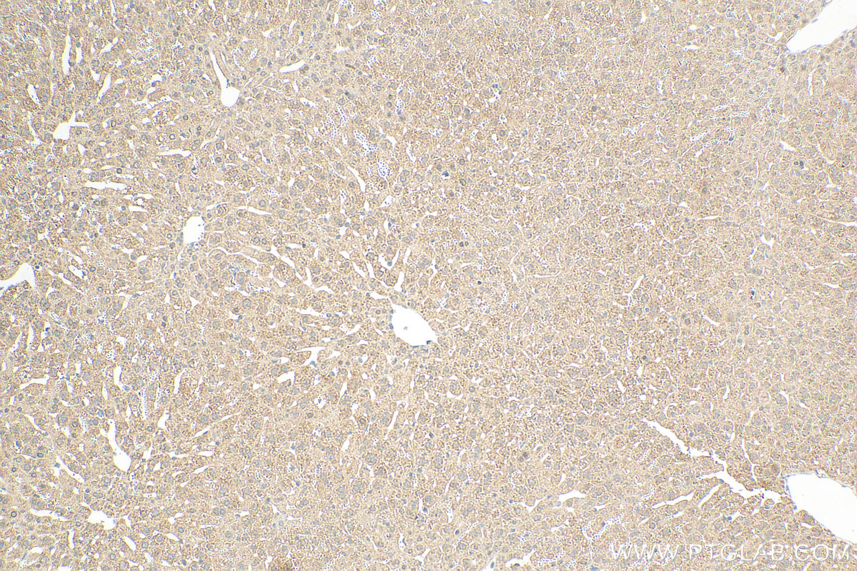 IHC staining of mouse liver using 68180-1-Ig (same clone as 68180-1-PBS)