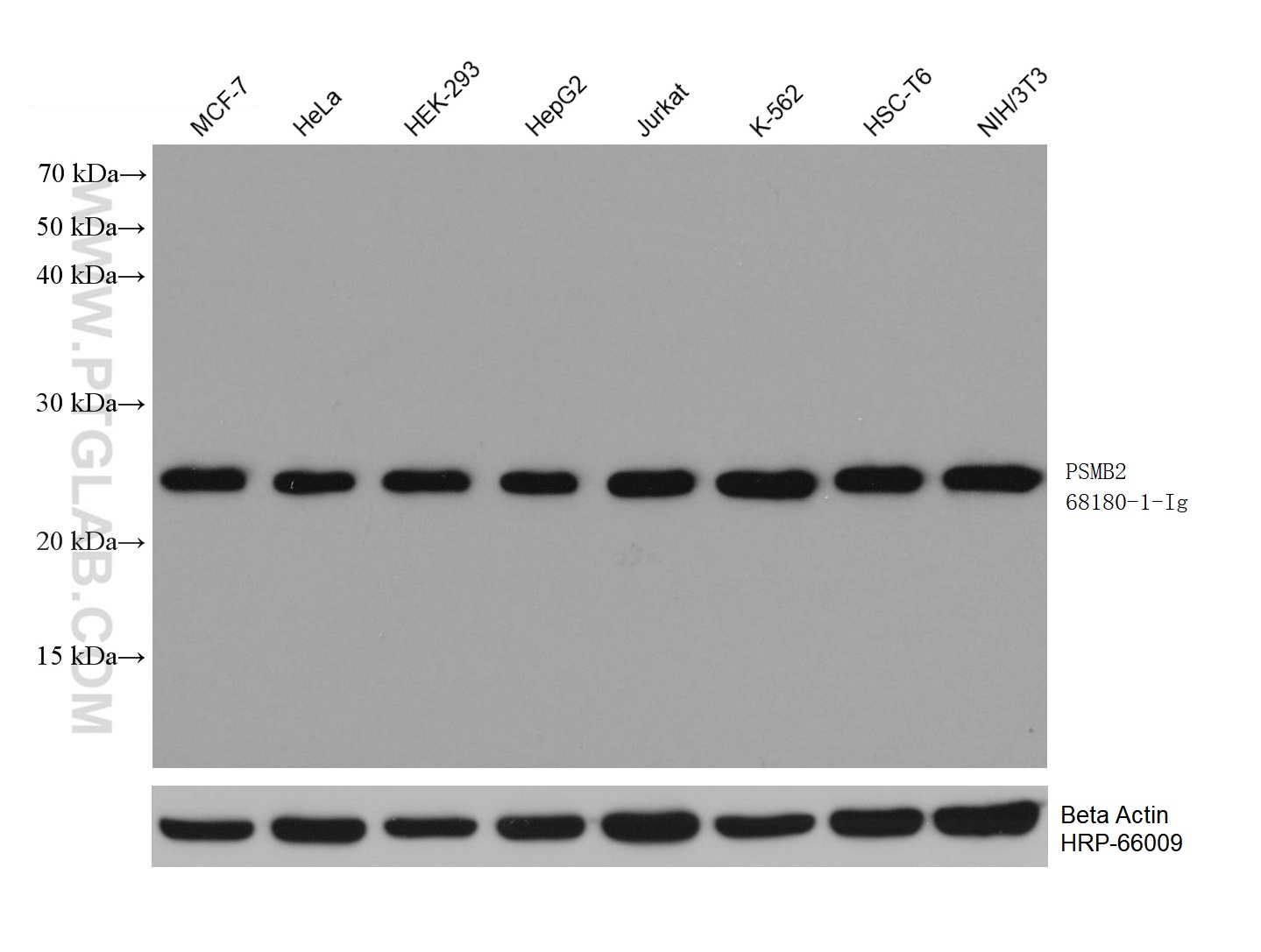 WB analysis using 68180-1-Ig (same clone as 68180-1-PBS)
