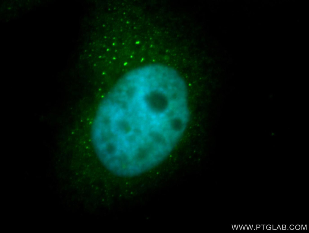 IF Staining of MCF-7 using 11029-1-AP